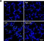 Rat IgG (H+L) Cross-Adsorbed Secondary Antibody in Immunohistochemistry (Paraffin) (IHC (P))