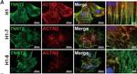 Mouse IgG (H+L) Highly Cross-Adsorbed Secondary Antibody in Immunocytochemistry (ICC/IF)