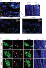 Rabbit IgG (H+L) Cross-Adsorbed Secondary Antibody in Immunohistochemistry (Frozen) (IHC (F))