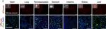 Rabbit IgG (H+L) Highly Cross-Adsorbed Secondary Antibody in Immunohistochemistry (PFA fixed) (IHC (PFA))