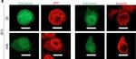 Rabbit IgG (H+L) Cross-Adsorbed Secondary Antibody in Immunocytochemistry (ICC/IF)