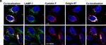 Mouse IgG (H+L) Highly Cross-Adsorbed Secondary Antibody in Immunocytochemistry (ICC/IF)