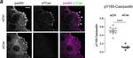 Rabbit IgG (H+L) Cross-Adsorbed Secondary Antibody in Immunocytochemistry (ICC/IF)