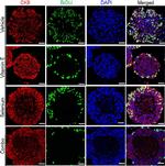 Rat IgG (H+L) Cross-Adsorbed Secondary Antibody in Immunocytochemistry (ICC/IF)