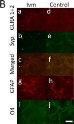 Mouse IgG (H+L) Cross-Adsorbed Secondary Antibody in Immunocytochemistry (ICC/IF)