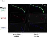 Rabbit IgG (H+L) Highly Cross-Adsorbed Secondary Antibody in Immunocytochemistry (ICC/IF)