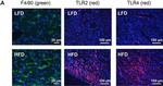 Rabbit IgG (H+L) Highly Cross-Adsorbed Secondary Antibody in Immunohistochemistry (IHC)