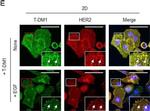 Mouse IgG1 Cross-Adsorbed Secondary Antibody in Immunocytochemistry (ICC/IF)