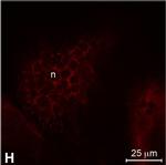 Rabbit IgG (H+L) Highly Cross-Adsorbed Secondary Antibody in Immunocytochemistry (ICC/IF)