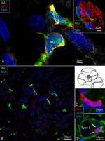 IBA1 Antibody in Immunohistochemistry (IHC)