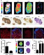 LYVE1 Antibody in Immunohistochemistry (IHC)