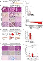 CD45 Antibody in Immunohistochemistry (IHC)