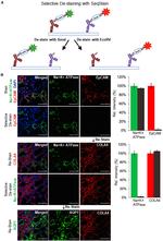 Collagen IV Antibody in Immunohistochemistry (IHC)