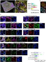 Collagen IV Antibody in Immunohistochemistry (IHC)