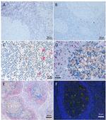 CD107a (LAMP-1) Antibody in Immunohistochemistry (IHC)