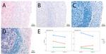 FOXP3 Antibody in Immunohistochemistry (IHC)