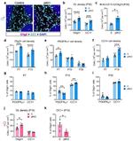 CD140a (PDGFRA) Antibody in Immunohistochemistry (IHC)