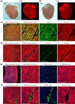 CD140b (PDGFRB) Antibody in Immunocytochemistry (ICC/IF)