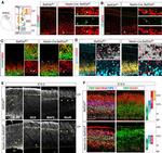 EOMES Antibody in Immunohistochemistry (IHC)