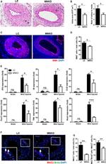 Galectin 3 Antibody in Immunohistochemistry (IHC)