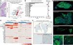 Ki-67 Antibody in Immunohistochemistry (IHC)