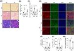 Ki-67 Antibody in Immunohistochemistry (IHC)