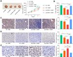 Ki-67 Antibody in Immunohistochemistry (IHC)