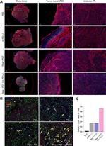 FOXP3 Antibody in Immunohistochemistry (IHC)