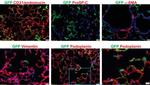 Endomucin Antibody in Immunohistochemistry (IHC)