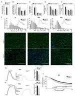 Laminin Antibody in Immunohistochemistry (IHC)