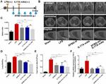 IL-17A Antibody in Neutralization (Neu)