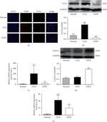 CX3CL1 (Fractalkine) Antibody in Western Blot (WB)