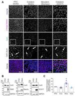 Nestin Antibody in Western Blot, Immunocytochemistry (WB, ICC/IF)