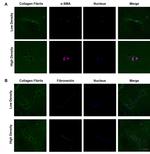 Fibronectin Antibody in Immunocytochemistry (ICC/IF)