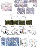 M-CSF Antibody in Immunohistochemistry (IHC)