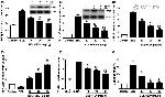 Phospho-SMAD3 (Ser423, Ser425) Antibody in Western Blot (WB)