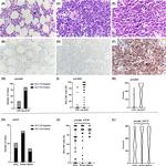 BCL11B Antibody in Immunohistochemistry (IHC)