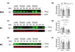 TPH2 Antibody in Western Blot (WB)