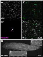 Phospho-Histone H3 (Ser10) Antibody in Immunohistochemistry (IHC)