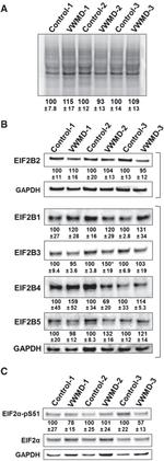 eIF2b alpha Antibody in Western Blot (WB)