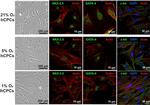 GATA4 Antibody in Immunocytochemistry (ICC/IF)