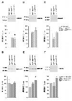 Ubiquilin 1 Antibody in Western Blot (WB)