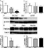 PMCA2 ATPase Antibody in Western Blot (WB)