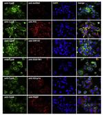 SQSTM1 Antibody in Immunocytochemistry (ICC/IF)