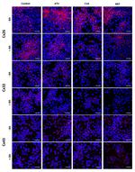 Connexin 26 Antibody in Immunocytochemistry (ICC/IF)