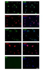 PLZF Antibody in Immunocytochemistry (ICC/IF)