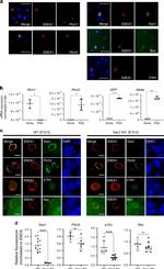 PTCH2 Antibody in Immunocytochemistry (ICC/IF)