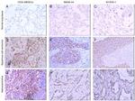 NY-ESO-1 Antibody in Immunohistochemistry (IHC)