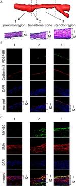 VE-cadherin Antibody in Immunohistochemistry (IHC)