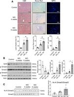 Myeloperoxidase Antibody in Immunohistochemistry (IHC)